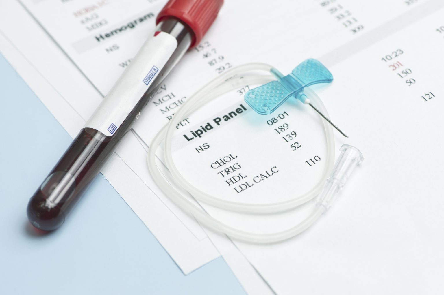 cholesterol-test-lipid-panel